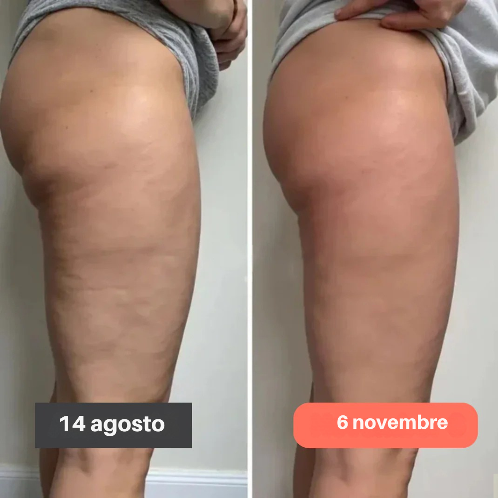 Leggings 3D – Ridefinisci la tua silhouette senza sforzo